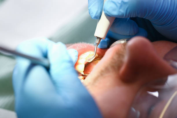 Best Emergency Gum Treatment in Nephi, UT