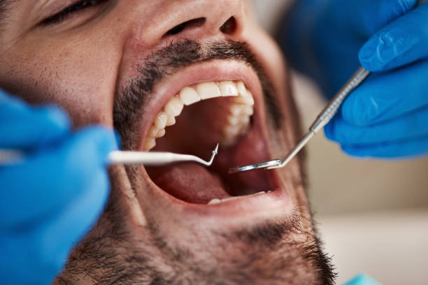 Best Emergency Dental Care for Broken or Chipped Teeth in Nephi, UT