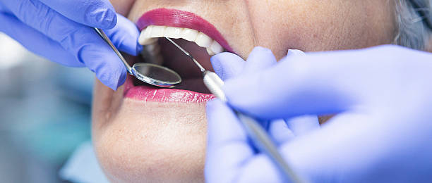 Best Emergency Treatment for Dental Infections or Abscesses in Nephi, UT
